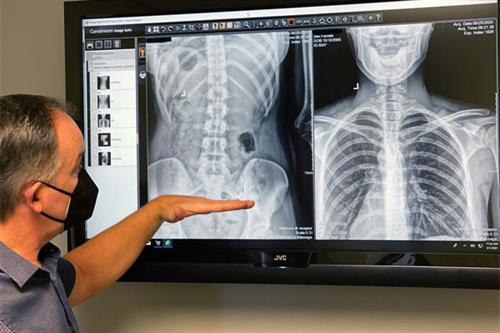 State-of-the-art Digital Xray