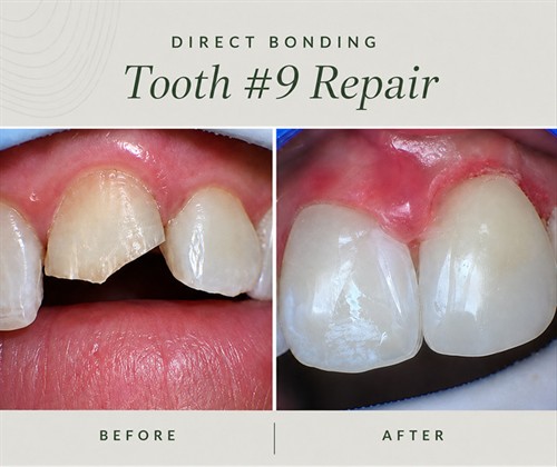 Check out some of our cosmetic work!