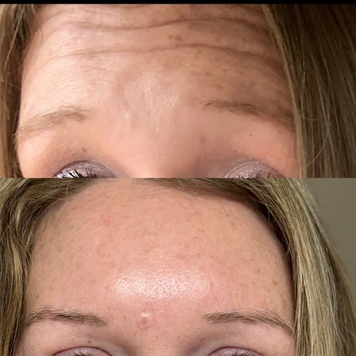 Gallery Image 12A0EA31-E8FE-4AB5-B902-A703D955324A.jpeg