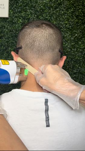Laser Hair Removal for men, back of neck.