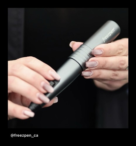 Freezpen Cryotherapy is a non invasive procedure to treat all types of benign skin lesions.