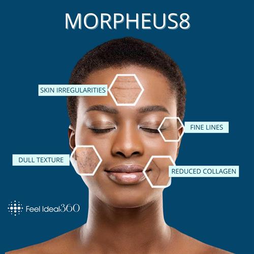 Morpheus 8 Laser Face Rejuvenation