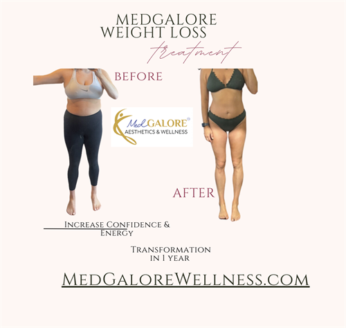 MedGalore Weight Loss Success!