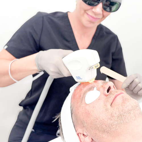 Gallery Image sundara-medical-photofacial.jpg