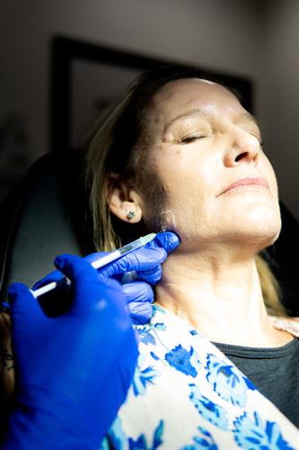 Botox treatment in Masseters. Advanced Beauty Injector: Kasey