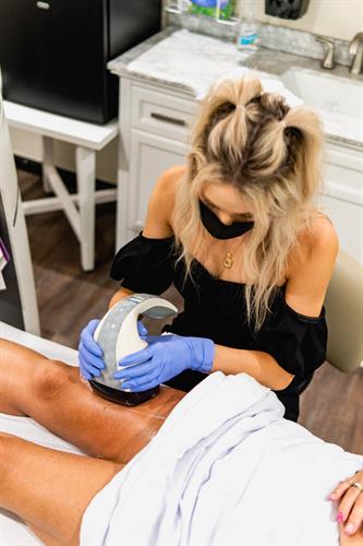 Velashape treatment performed on thighs to help with cellulite. Advanced Laser Nurse: Kylie