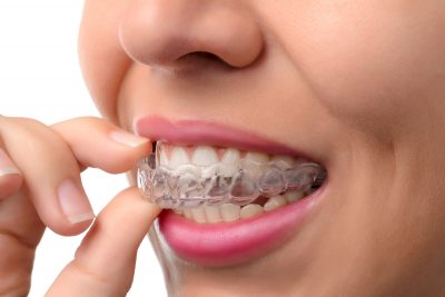 Offering Invisalign and SureSmile