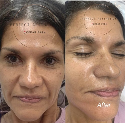 Facial Balancing
