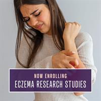 How to Participate in an Eczema Clinical Trial