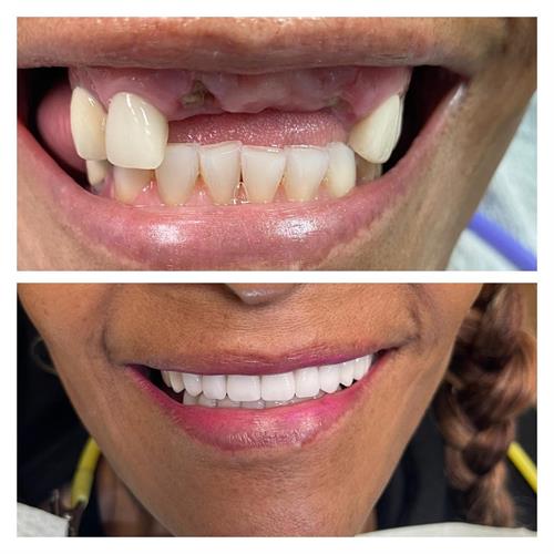We create your Beautiful Smile