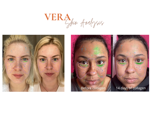 Gallery Image BNI_NU_Skin_Presentation_20256.png Gallery Image BNI_NU_Skin_Presentation_20256.png