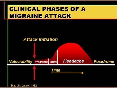 Gallery Image Clinical_Phases_Migraine.JPG
