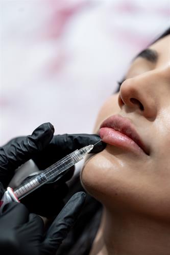 Lip filler specialists