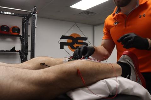 Dry Needling