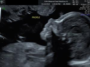 Advocate Ultrasound Solutions