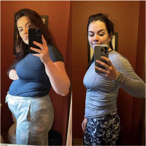 1st pic is 10 months after baby #1 and 2nd is 10 months after baby #2.  1st pic is w/out Rise & 2nd one with Rise