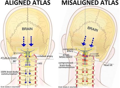 Gallery Image Atlas_axis_misalignment.jpg