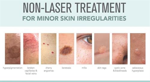 Skin lesions treated with the Skin Classic