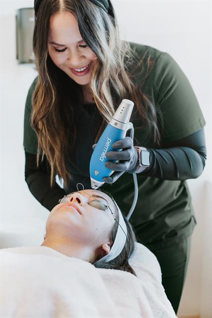 Microneedling is great for younger healthy looking skin!