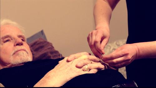 acupuncture acupuncture