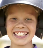 Understanding Buck Teeth (Overjet): Why Early Orthodontic Care Matters for Brookhaven Families