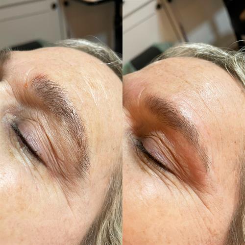 Brow cleanup
