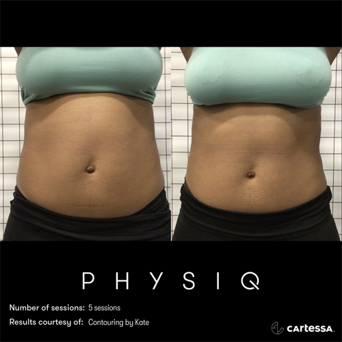 physiq results