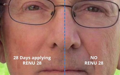 Visible Results in 28 Days with RENU28