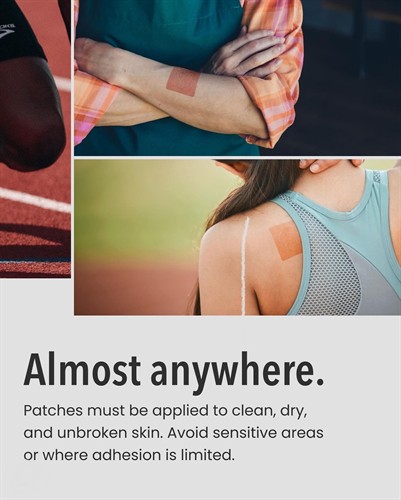 Can Patches be placed anywhere?