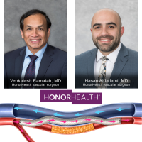 HonorHealth is first provider in AZ to perform procedure for complex peripheral artery disease
