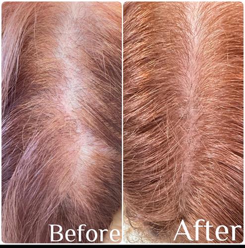 Before  & After  Hair rejuvenation