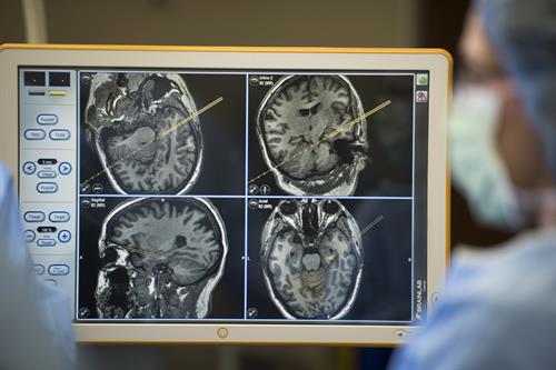 Our neurologists and neurosurgeons offer a variety of treatment options for your brain and spine needs. 