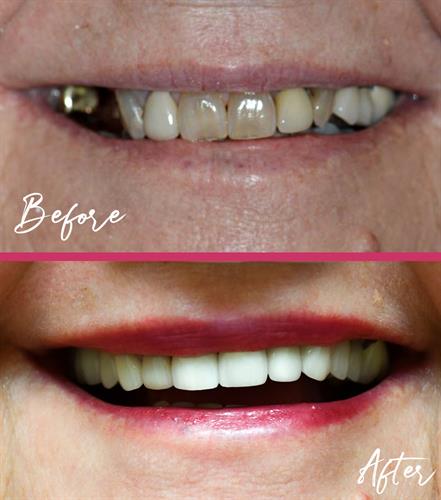 Dr. Catherine Young restores smiles and self confidence through state-of-the-art dentistry. Dr. Catherine Young restores smiles and self confidence through state-of-the-art dentistry.