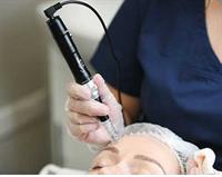 Microneedling appointments are now being scheduled