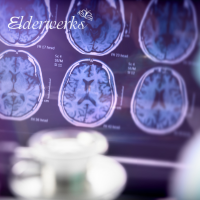 Understanding Alzheimer's and Dementia