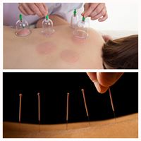 Nashville Acupuncture Clinic PLLC - Nashville 