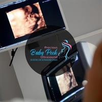 Precious Baby Peek Ultrasound