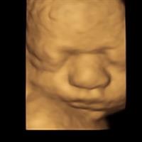 Precious Baby Peek Ultrasound - New Bern