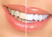 Spring Dental - Altamonte Springs