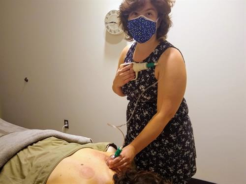 Gallery Image Amanda-massage-cupping-therapist-Renu-Greenway-Station-working-client-cups-back-horizontal.jpg