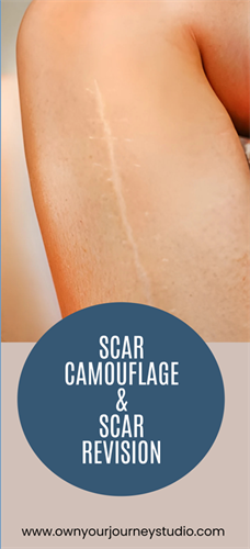 Scar Camouflage and Revision 