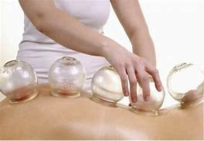 Professional Dry Cupping Therapy