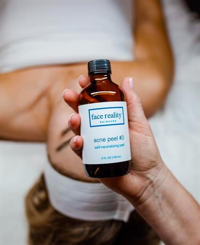 Face Reality Acne Services 