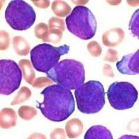The Biology of Cancer