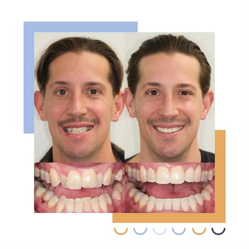 Gallery Image Before_and_After_Smile-.jpg