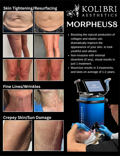 Morpheus8 - Skin Tightening, Boost Collagen & Elastin Production, naturally!