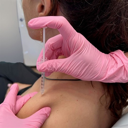 Gallery Image traptox.jpg