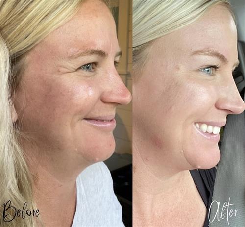 Crows Before & After
