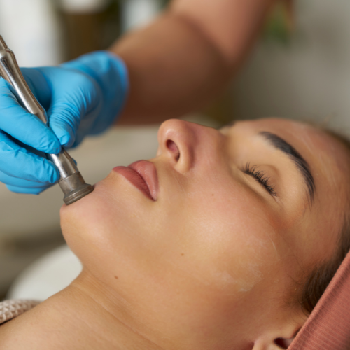 Congestion, rough texture and dullness respond best to controlled, professional exfoliation — not harsh scrubbing at home. Each pass is adjusted to your skin on the day, by a practitioner trained to read it.
