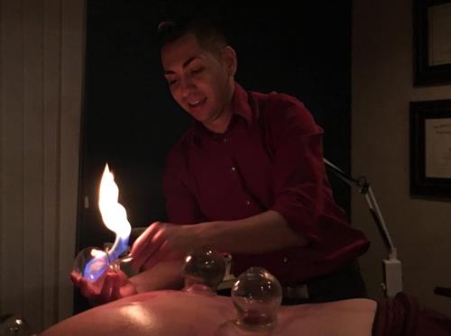 Gallery Image Fire_Cupping.jpg Gallery Image Fire_Cupping.jpg